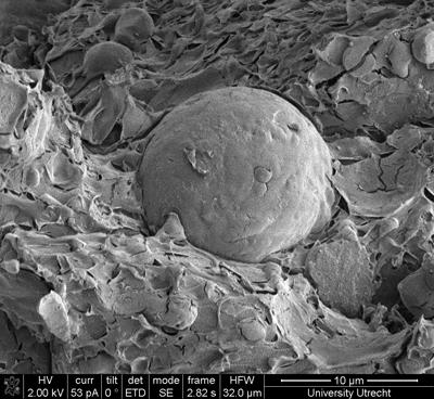 Cross-section image through sunscreen (courtesy of FEI Company and University of Utrecht)